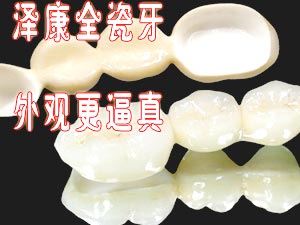 泽康全瓷牙 修复牙齿外观更逼真  