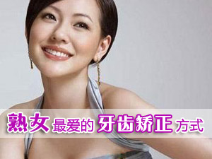 熟女最爱 隐形牙齿矫正