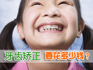 牙齿矫正要花多少钱？
