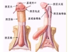 阴茎结构图