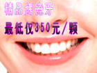 精品烤瓷牙最低仅350元/颗