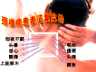 颈椎病 前100名患者中药熥疗免费