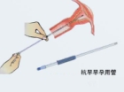 微管可视无痛人流