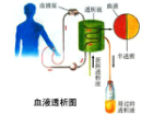 尿毒症-血液透析患者的福音