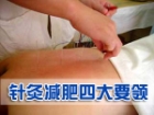 专家指点 针灸减肥四大要领