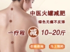 中医火罐减肥 拔出窈窕和美丽