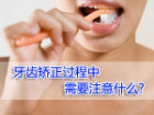 牙齿矫正过程中需要注意什么