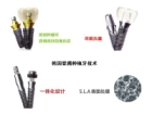 韩国登腾种植牙技术