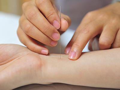 中医针灸